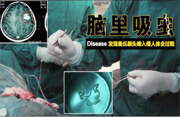 關注健康，防治食源性寄生蟲感染